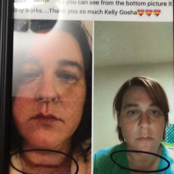 ❤️‍🩹CUSTOM w/ TEA TREE 🌳 OIL ❤️‍🩹😱 MIRACLE HEALING BALM! BEST IN BEAUTY!! - Picture 7 of 11